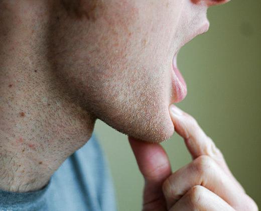 La mâchoire fait mal à l'ouverture de la bouche: les raisons et les recommandations pour l'élimination des sensations désagréables