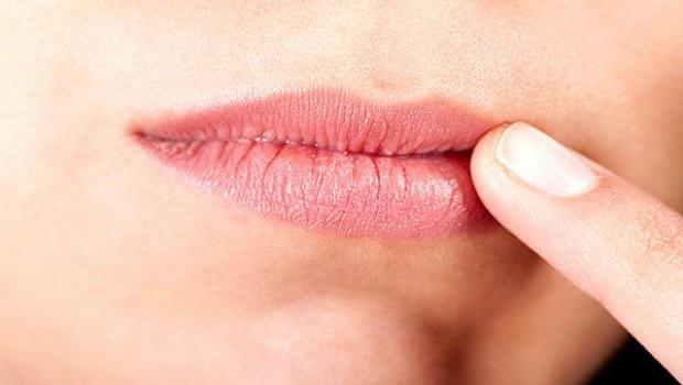 cheilitis sur les lèvres
