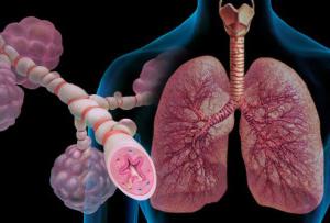 Classification de l'insuffisance respiratoire par type, pathogenèse, facteurs étiopathogéniques